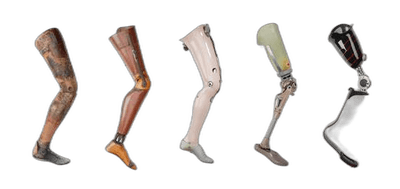 Prosthetics